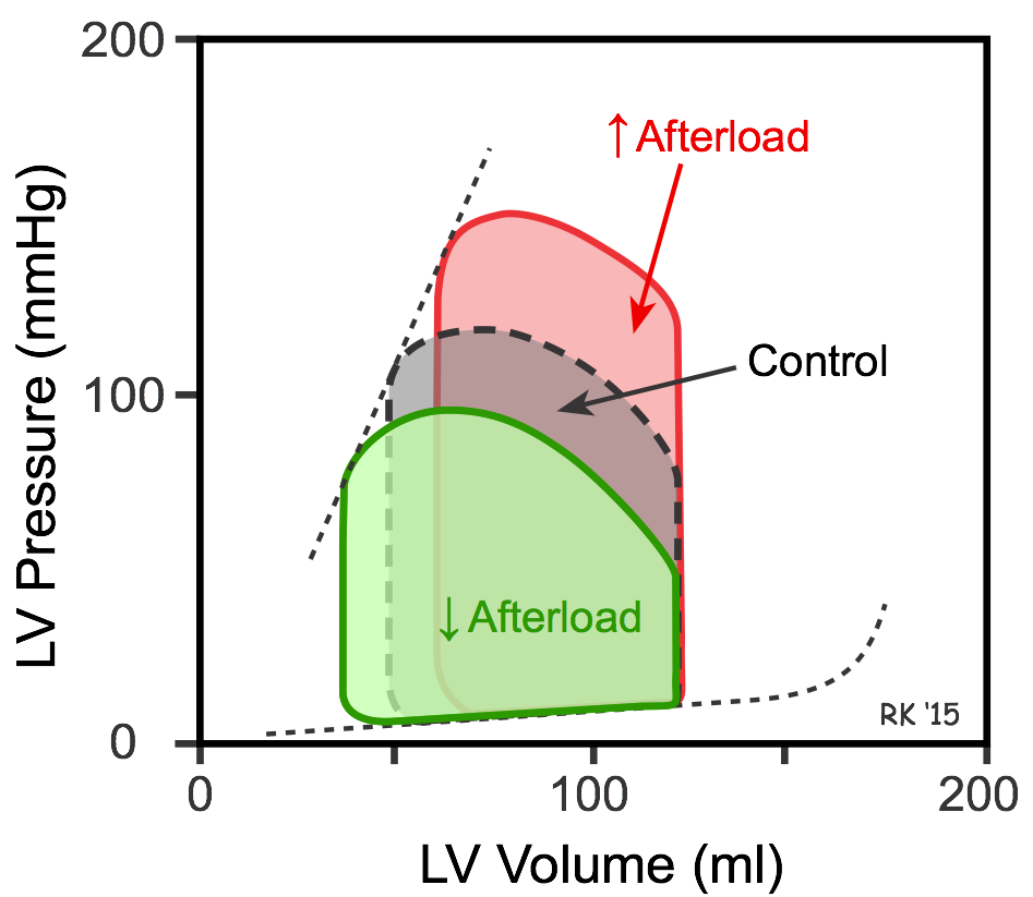 Afterload effects on ventricular pressure-volume loops